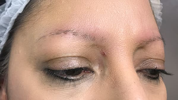 Picture of eyebrows before applying artificial eyebrows